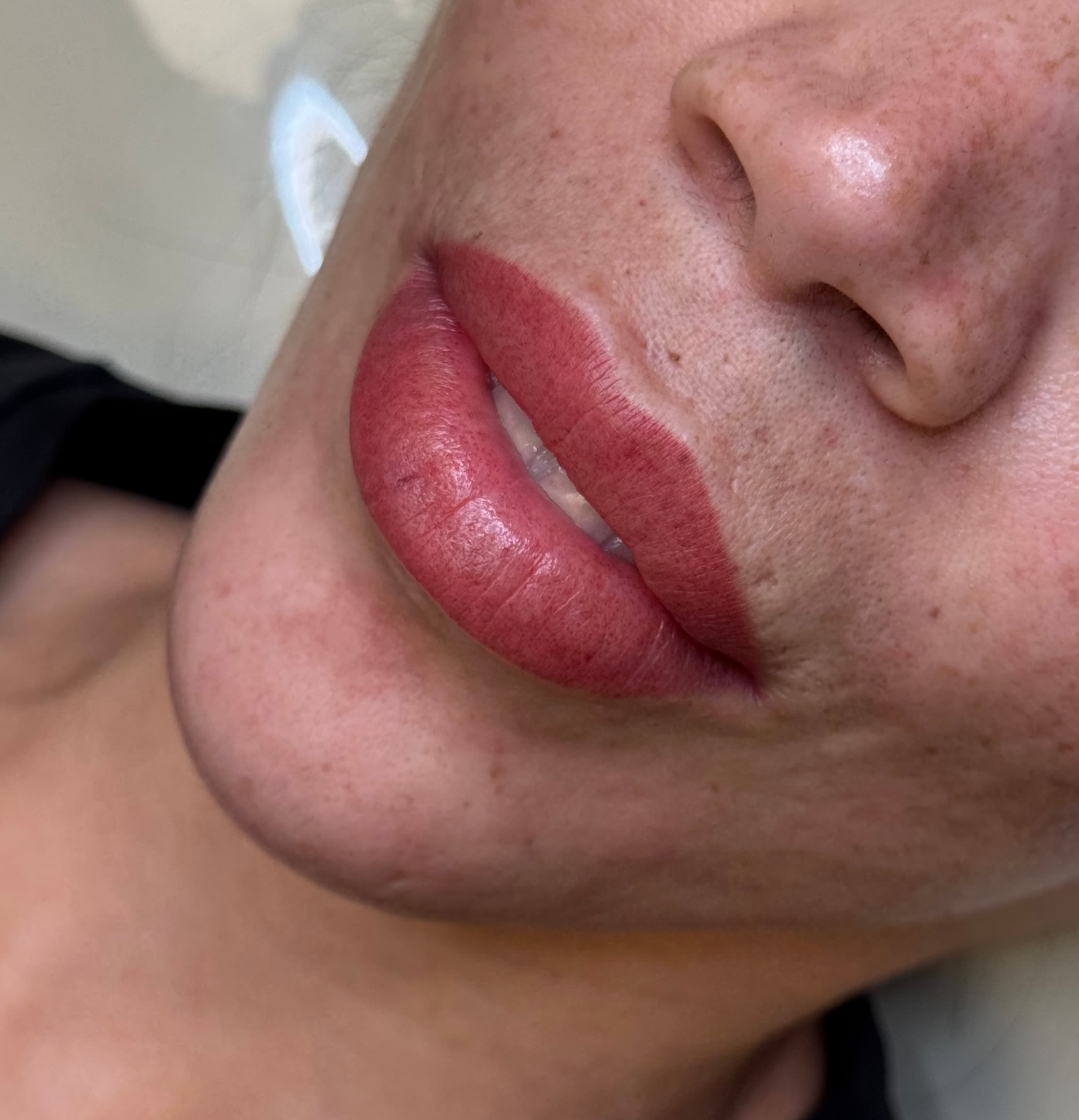 Fresh lip blush macro on freckled skin, full rosy result just after the procedure