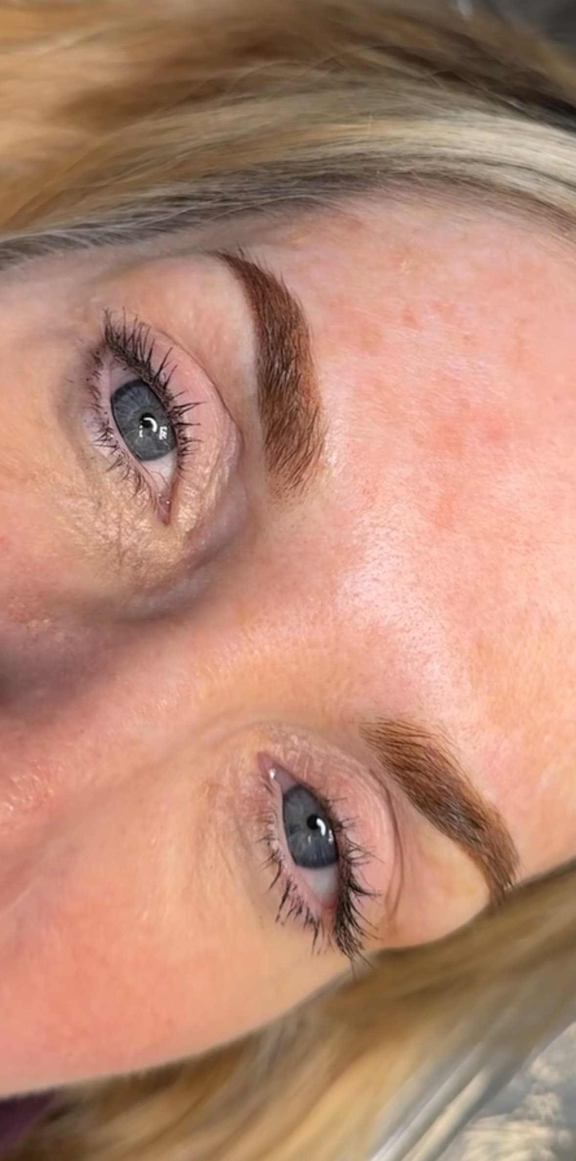 Healed combination brows on light skin, both brows visible